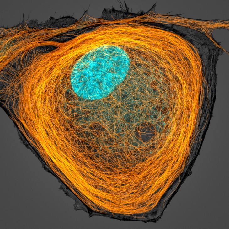 2020 Nikon Small World Contest Microtubules (orange) inside a cell. Nucleus is shown in cyan, by Jason Kirk