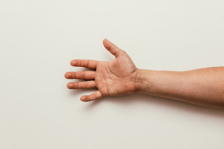 Study Finds Humans Are Evolving To Have 3 Arm Arteries forearm