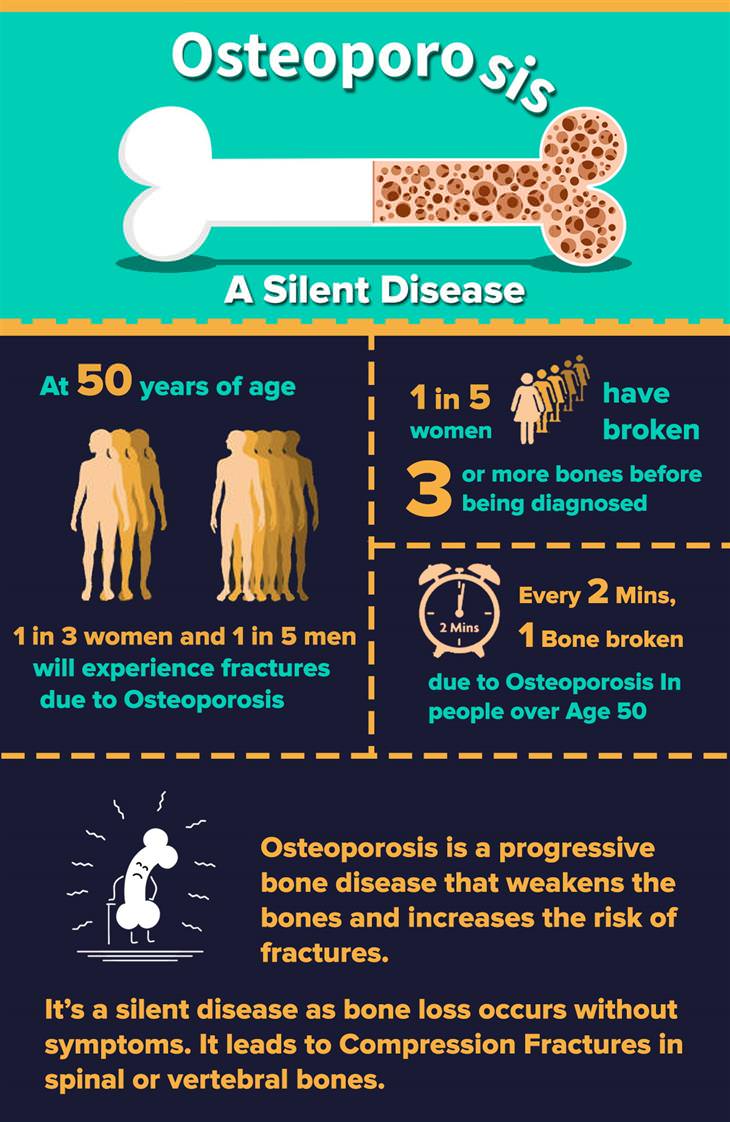 Osteoporosis Infographic 1