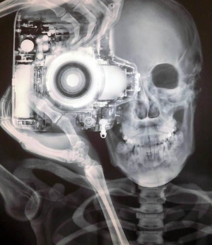 18 Remarkable Images That Offer a New Perspective, X-ray selfie