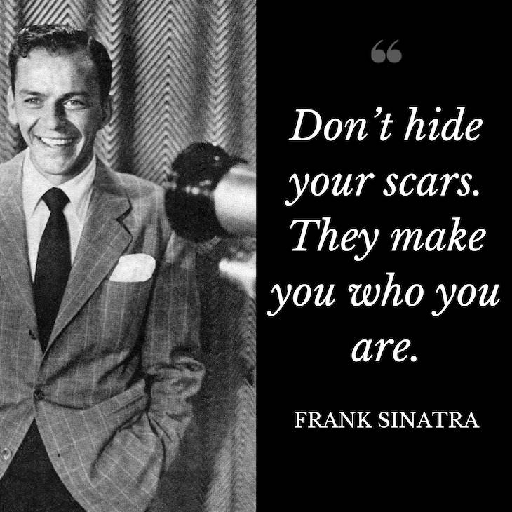 Frank Sinatra Quotes, Don’t hide your scars. They make you who you are