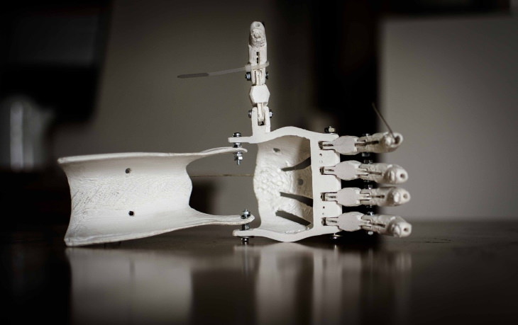 3D Printing prosthetics