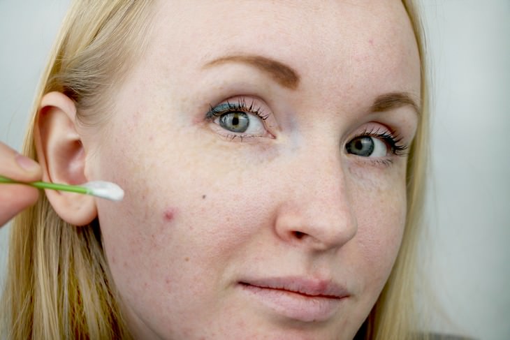 effective vintage beauty tips woman applying acne treatment