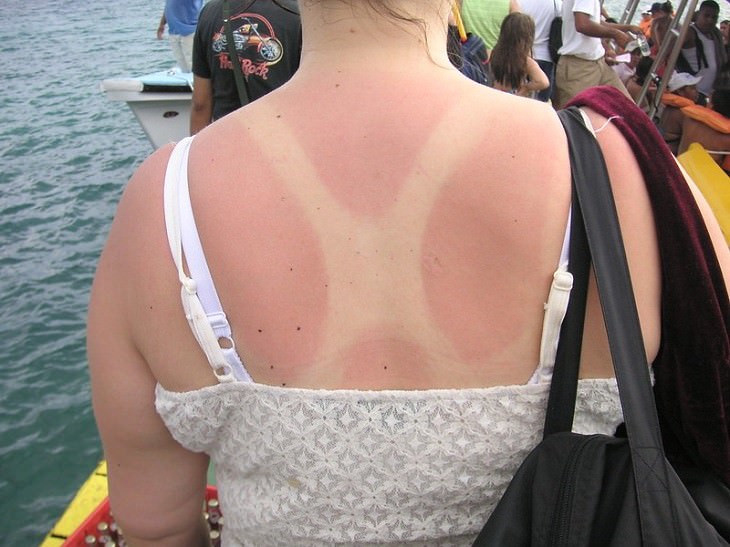 Health Benefits of Rosemary woman on a boat with a sunburn