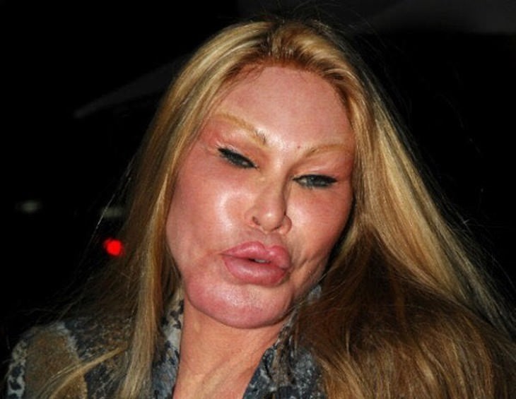 the World’s Strangest Addictions woman botchced plastic surgery