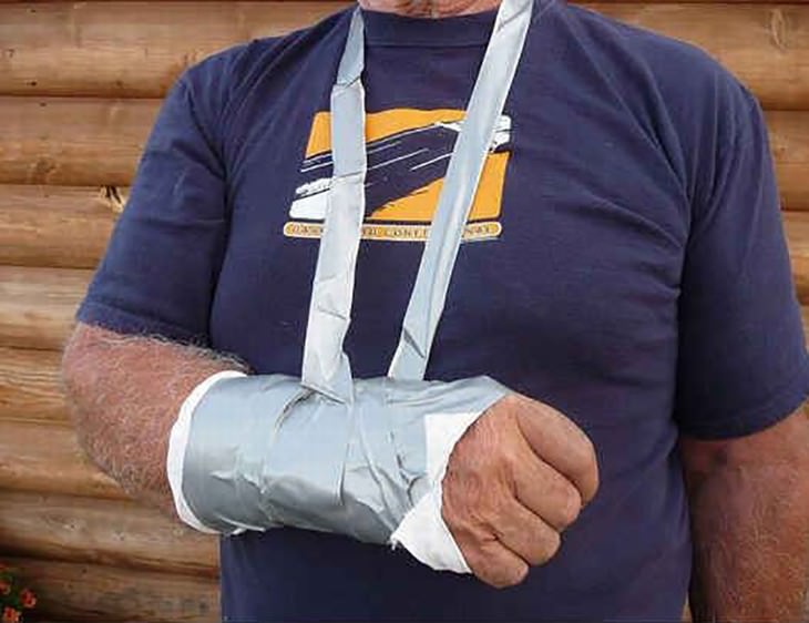 duct tape uses arm sling