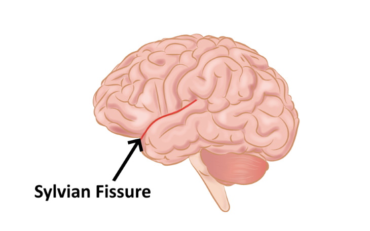 Machine Language Learning Sylvian Fissure