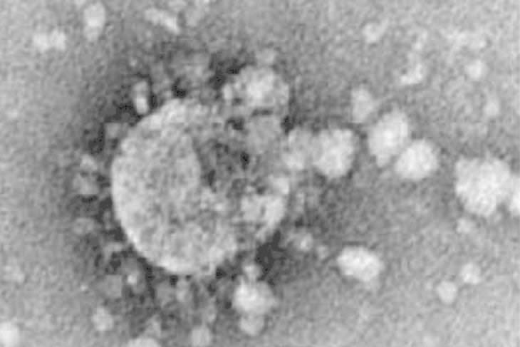 The 12 Deadliest Viruses in Human History SARS-CoV