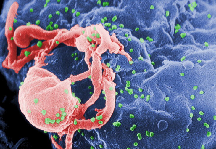The 12 Deadliest Viruses in Human History HIV