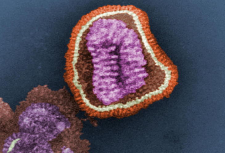 The 12 Deadliest Viruses in Human History Influenza
