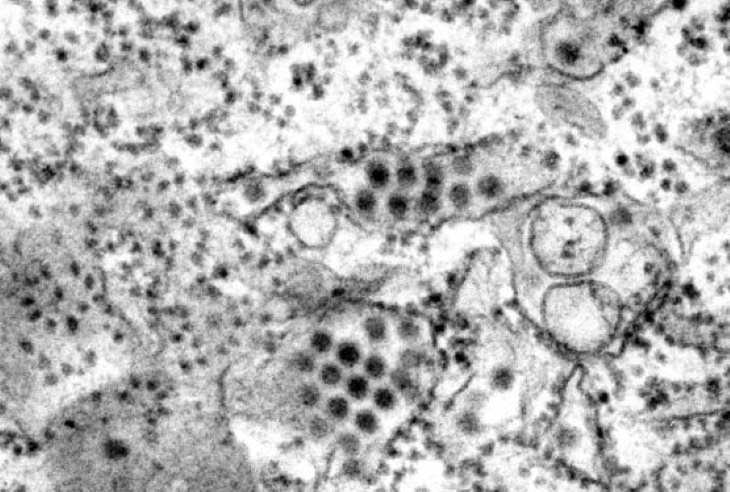 The 12 Deadliest Viruses in Human History dengue virus