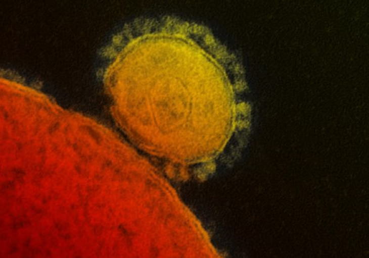 The 12 Deadliest Viruses in Human History MERS