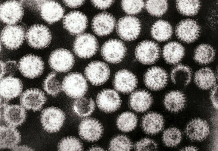 The 12 Deadliest Viruses in Human History Rotavirus