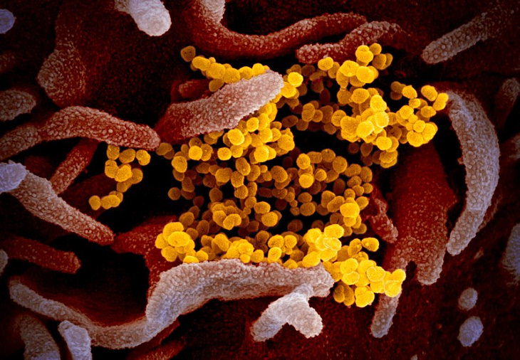 The 12 Deadliest Viruses in Human History SARS-CoV2