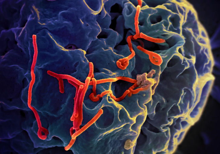 The 12 Deadliest Viruses in Human History Ebola