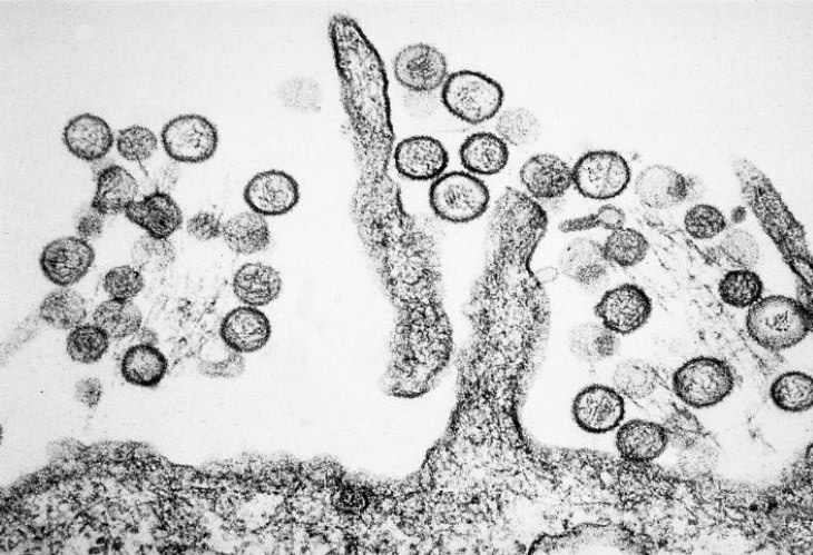 The 12 Deadliest Viruses in Human History Hantavirus