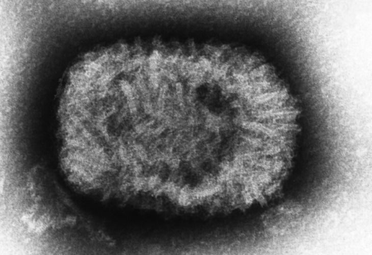 The 12 Deadliest Viruses in Human History Smallpox