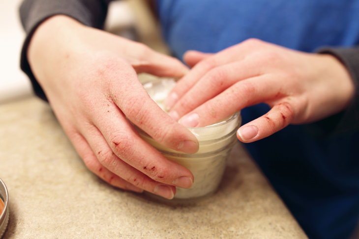 Guide to Cracked Skin dry hands 