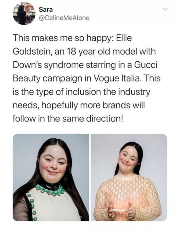 Wholesome Pics diversity in fashion Ellie Goldstein