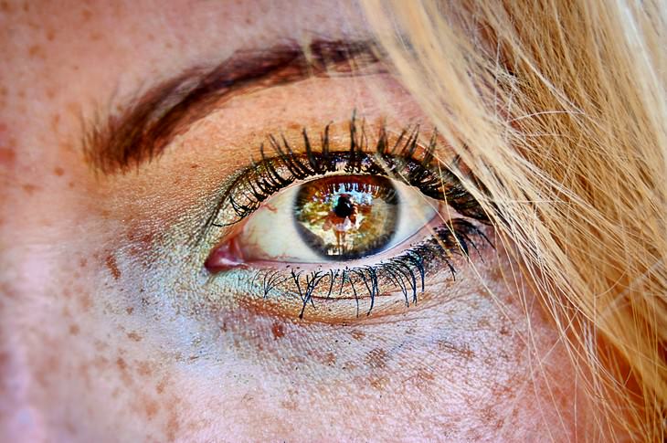 Surprising Reasons for Adult Eye Color Change iris freckles