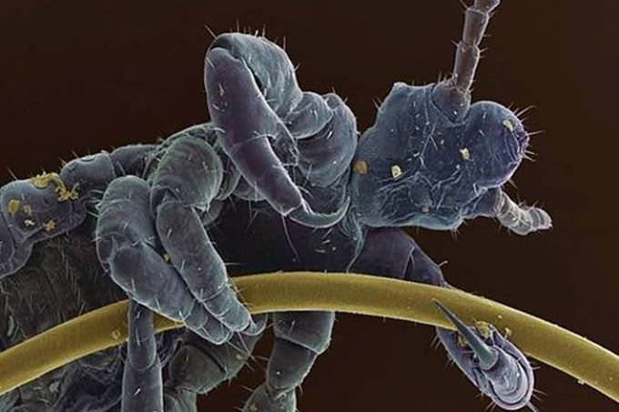 head louse under microscope