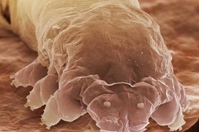 eyelash mite under microscope