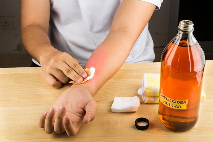 Home Remedies For Itching, Apple cider vinegar