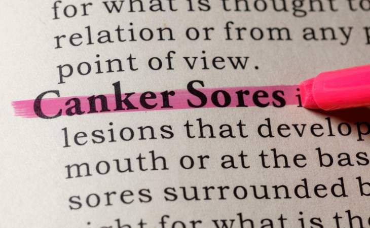 Canker Sores dictionary definition 