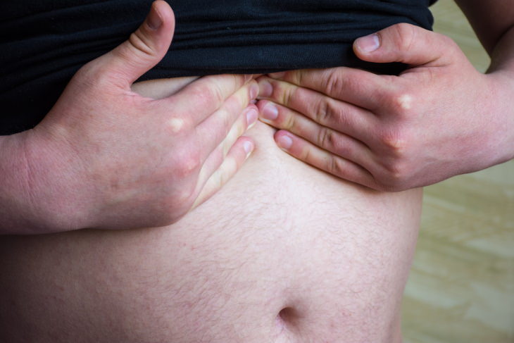 Types of Hernia Epigastric hernia