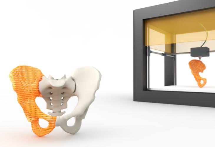 Things to Look Forward to in 2022, 3D-printed bone implants