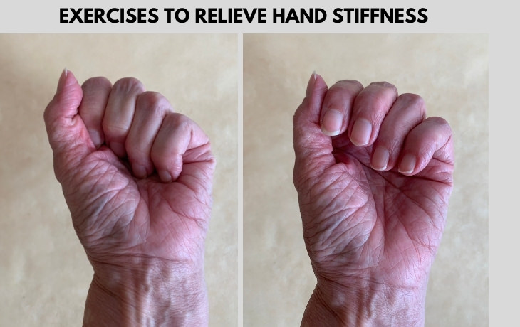 Hand Exercises for Arthritis