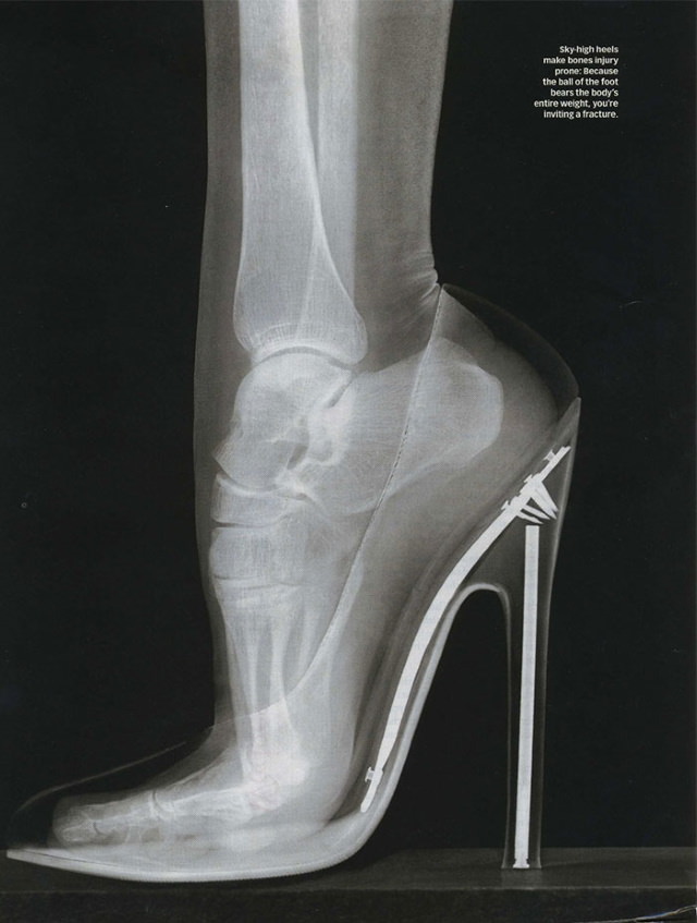 X-Rays wearing stilettos