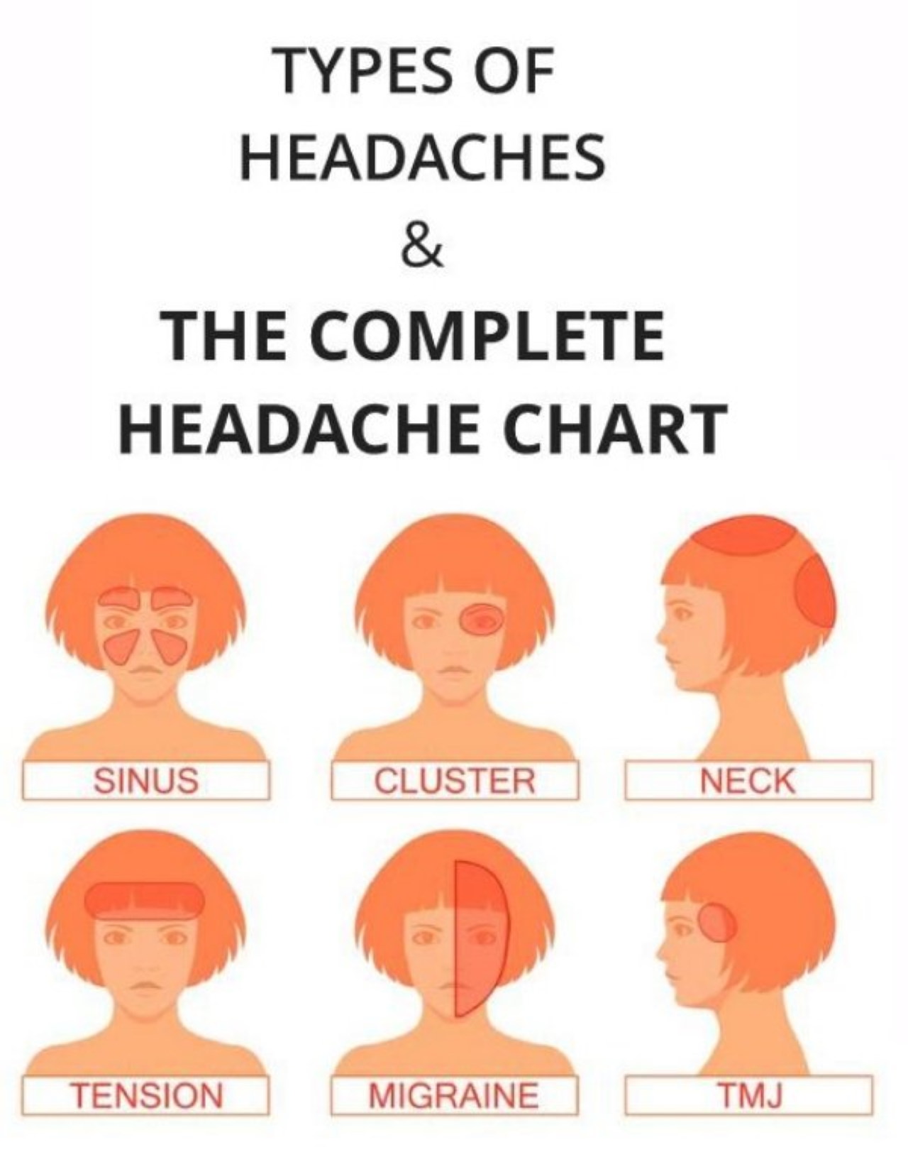 Болит затылок причины лечение. Типы головной боли. Головная боль в затылке. Головные боли по зонам головы. Головная боль в затылочной части головы.