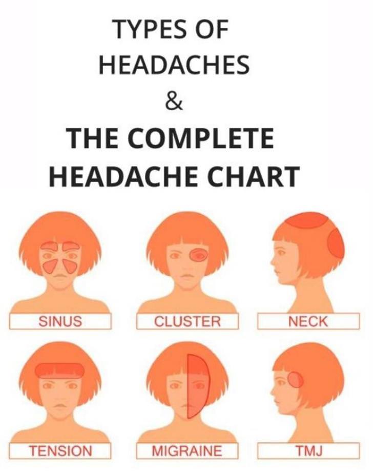 Charts types of headache