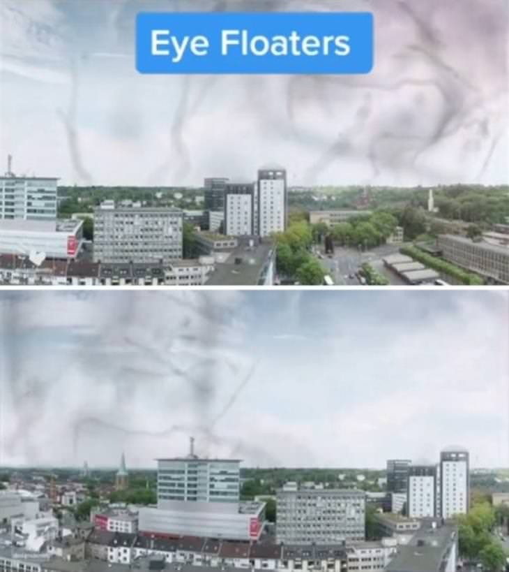 How People With Vision Limitations See the World eye floaters