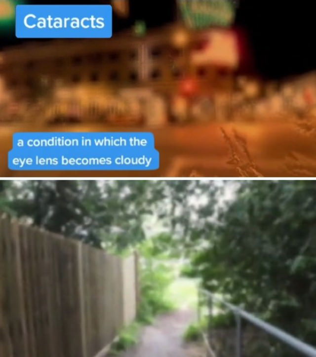 How People With Vision Limitations See the World Cataracts