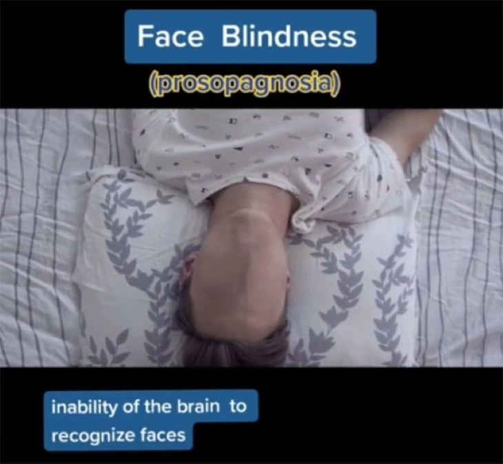 How People With Vision Limitations See the World Prosopagnosia