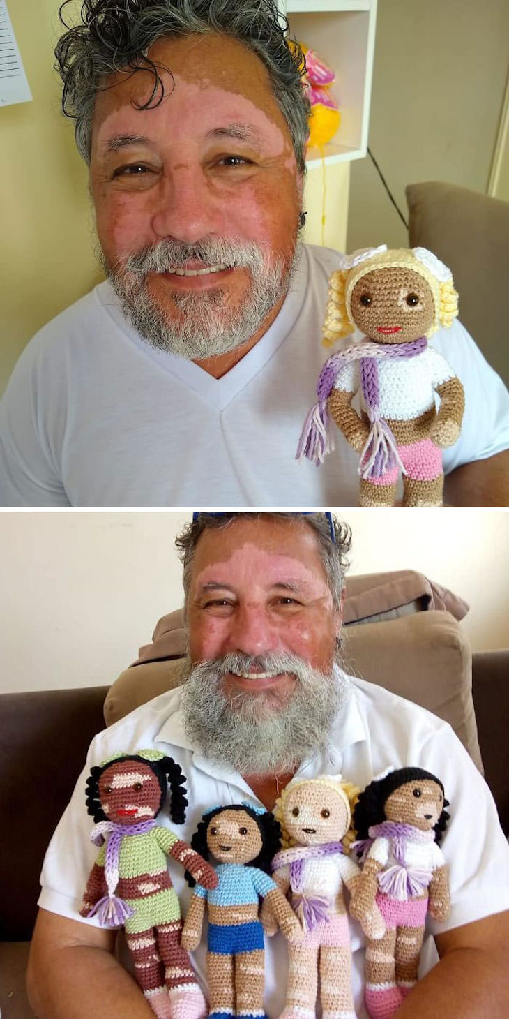 Wholesome Stories Proving Grandparents Are Awesome vitiligo dolls