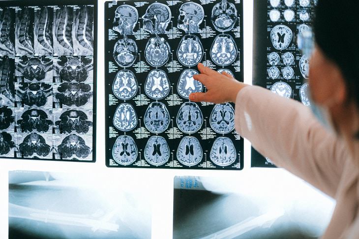 Speech Tech for Paralyzed Patients brain scan