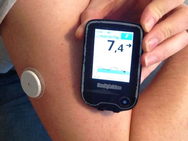 Study Finds CG monitors more efficient for diabetes patients, continuous glucose monitor