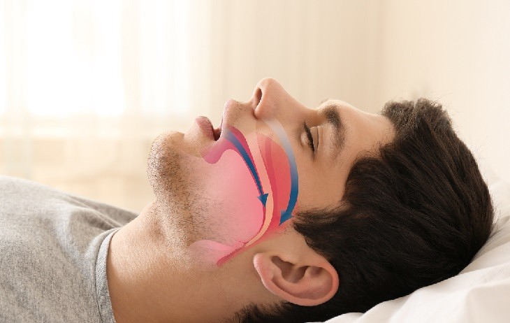 Snoring Causes man sleeping with open mouth