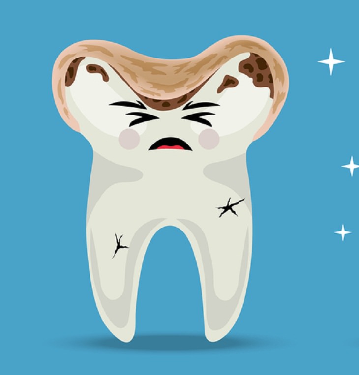 Risks of Over Brushing Your Teeth,  dental abrasion