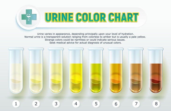 brown urine