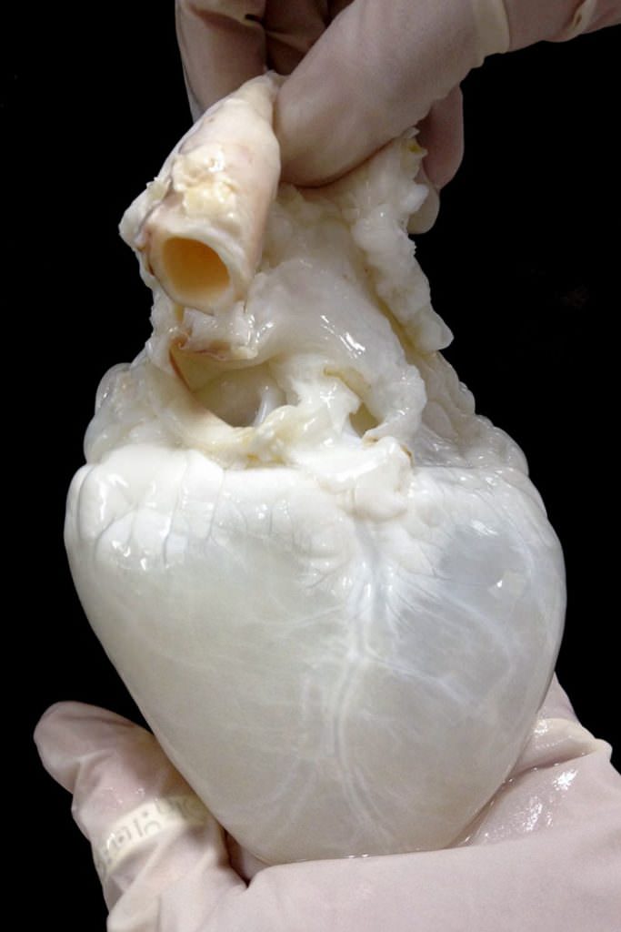 A heart that was drained from blood