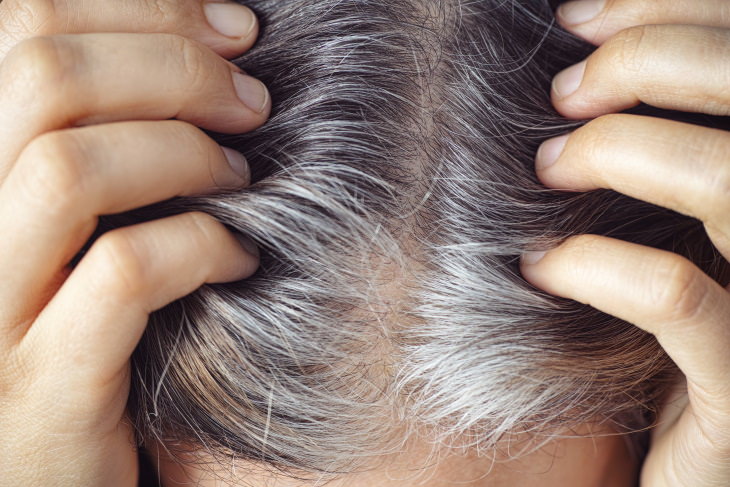 Gray Hair Causes gray hair closeup