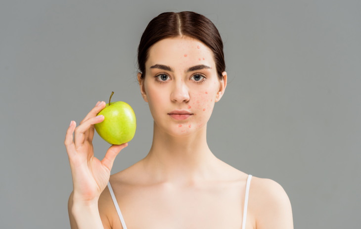 Apples Skin Benefits woman holding apple