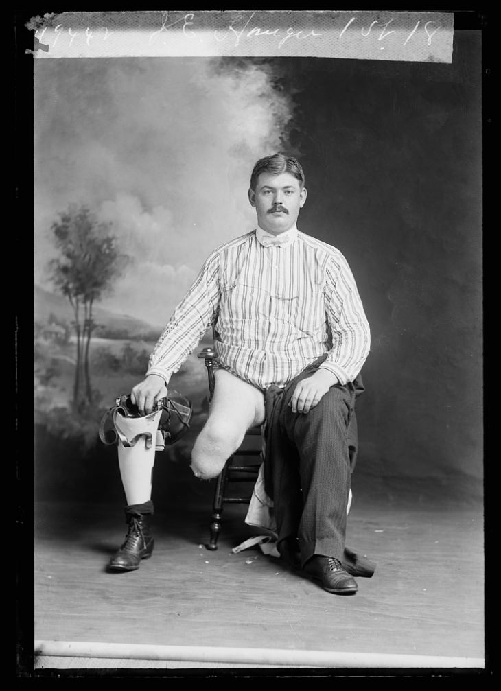 19th-Century Portraits man with amputated leg & prosthetic