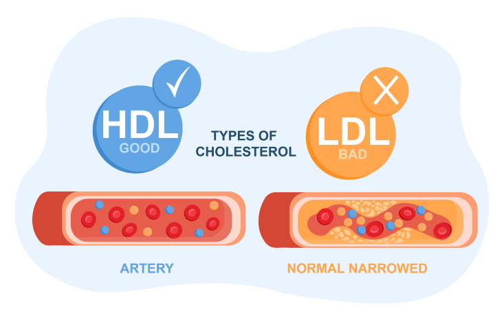 Safe High Cholesterol Foods types of cholesterol