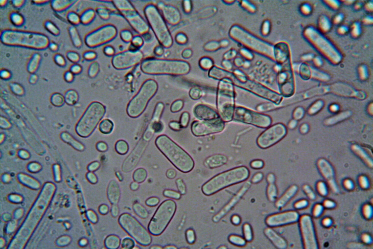 Gut Bacterium & Rheumatoid Arthritis Bacteria Under Microscope