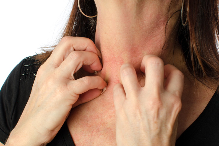 Types of Eczema itchy neck rash